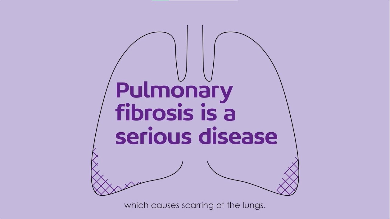 Pulmonary Fibrosis Awareness Month - 2024
