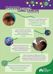 Understanding Lung Cancer Thumbnail