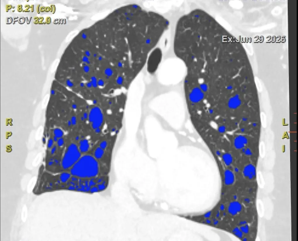 lung_ct_highres